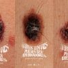 The scariest Monster campaña melanoma